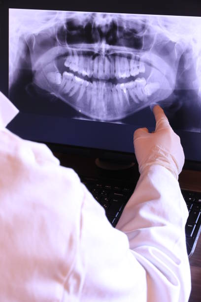 Best Emergency Dental Services for Seniors in Columbia, CA