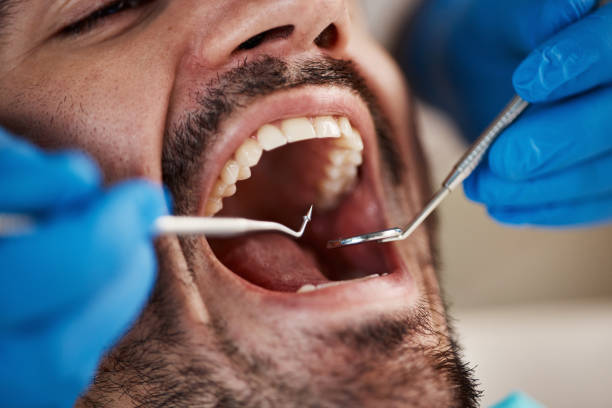 Best Weekend Emergency Dentist in Columbia, CA
