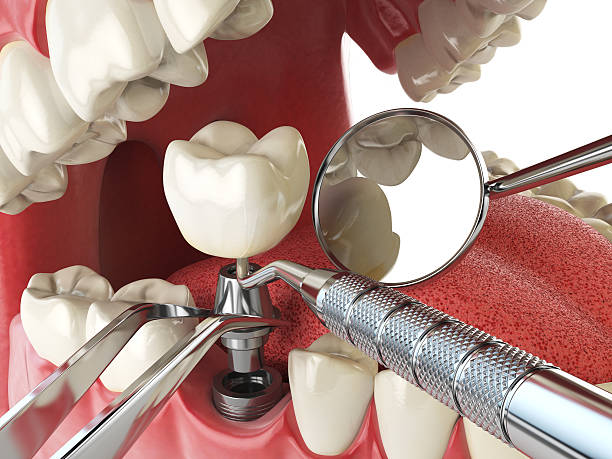 Best Orthodontic Emergency Dentist in Columbia, CA